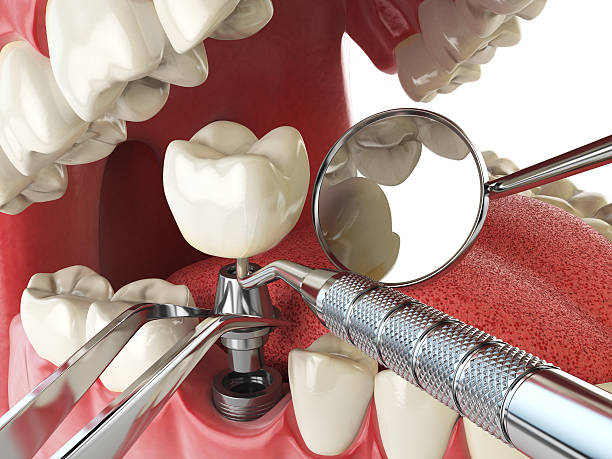 Best Emergency Treatment for Dental Infections or Abscesses in Franklin, NC
